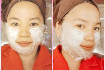 Face Thread Lift in Korea